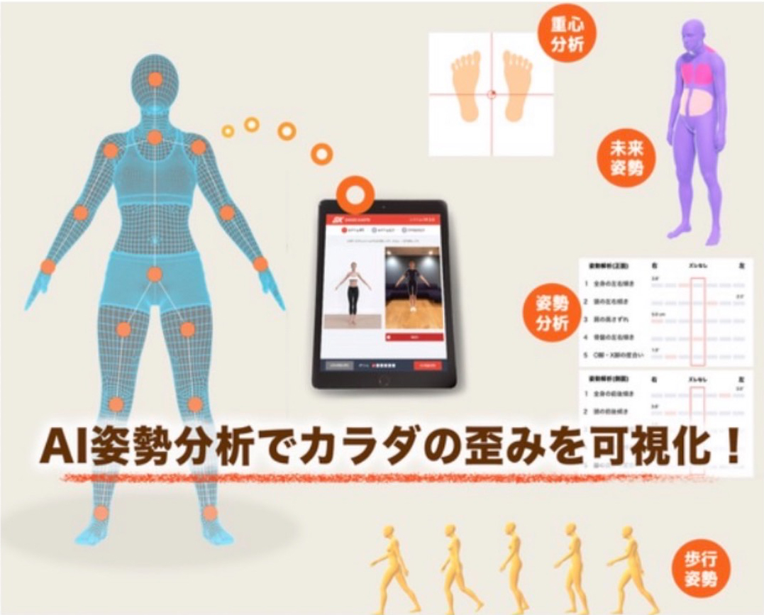 AIで姿勢を分析!シセイカルテについて